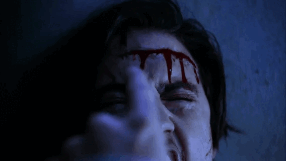 Archivo:Peter regeneración .gif